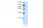CUGBP2 antibody - N-terminal region